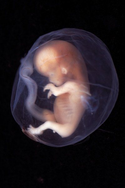 10-week-old-fetus_12-week-pregnancy