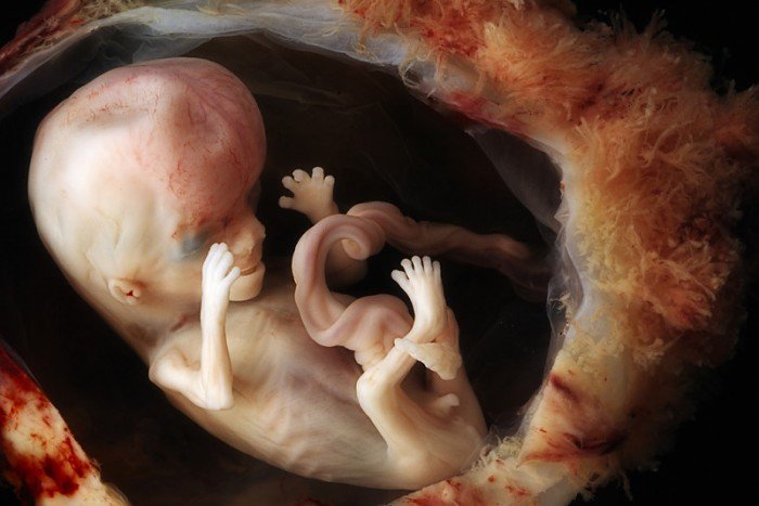 12-week-old-fetus_14-week-pregnancy