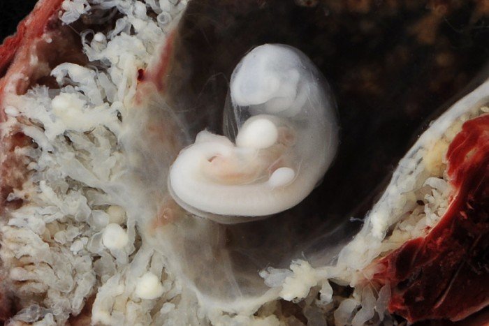 3-4-week-old-fetus_5-6-week-pregnancy