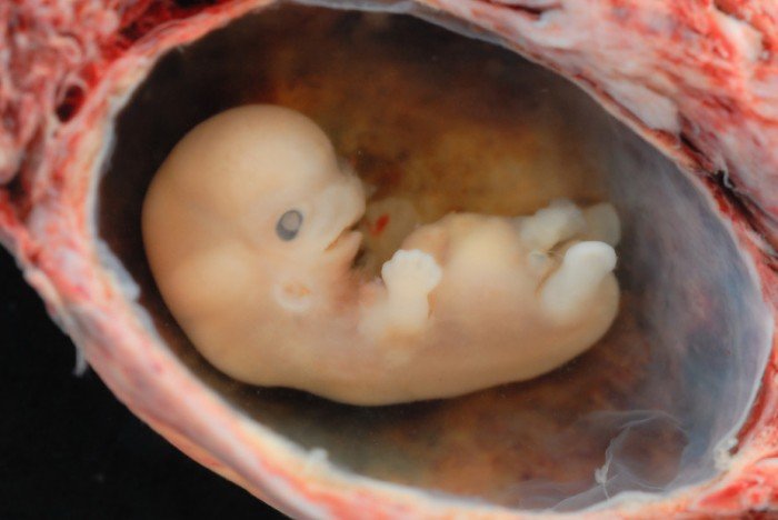 6-7-week-old-fetus_8-9-week-pregnancy