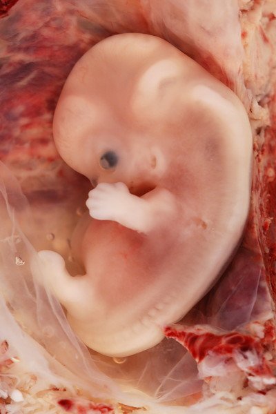 7-week-old-fetus_9-week-pregnancy