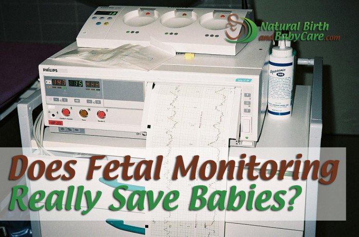 Does Fetal Monitoring Really Save Babies?