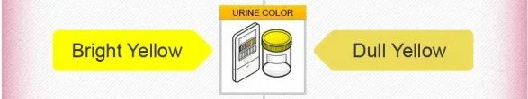 Graphic showing bright yellow urine can indicate a baby boy and dull urine can indicate a baby girl